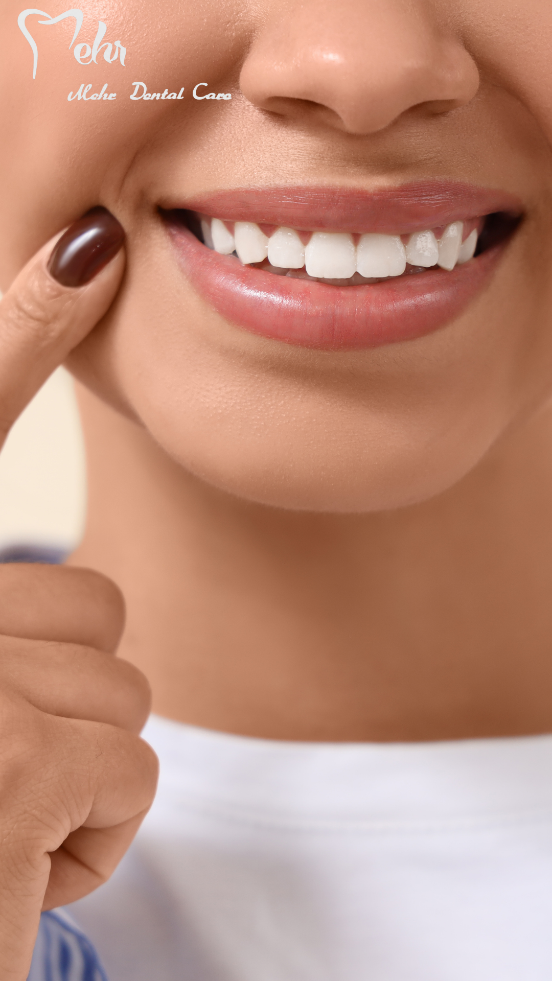 نمونه کار لمینت 1