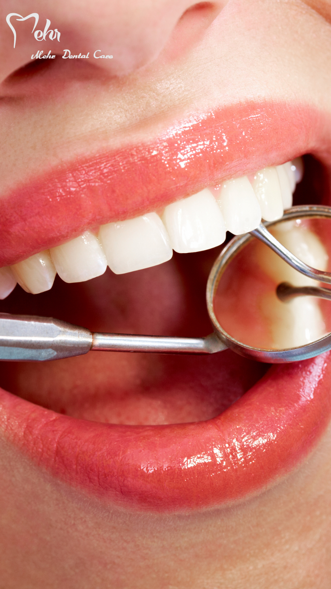 کاور ویدیو نمونه کار کامپوزیت 2