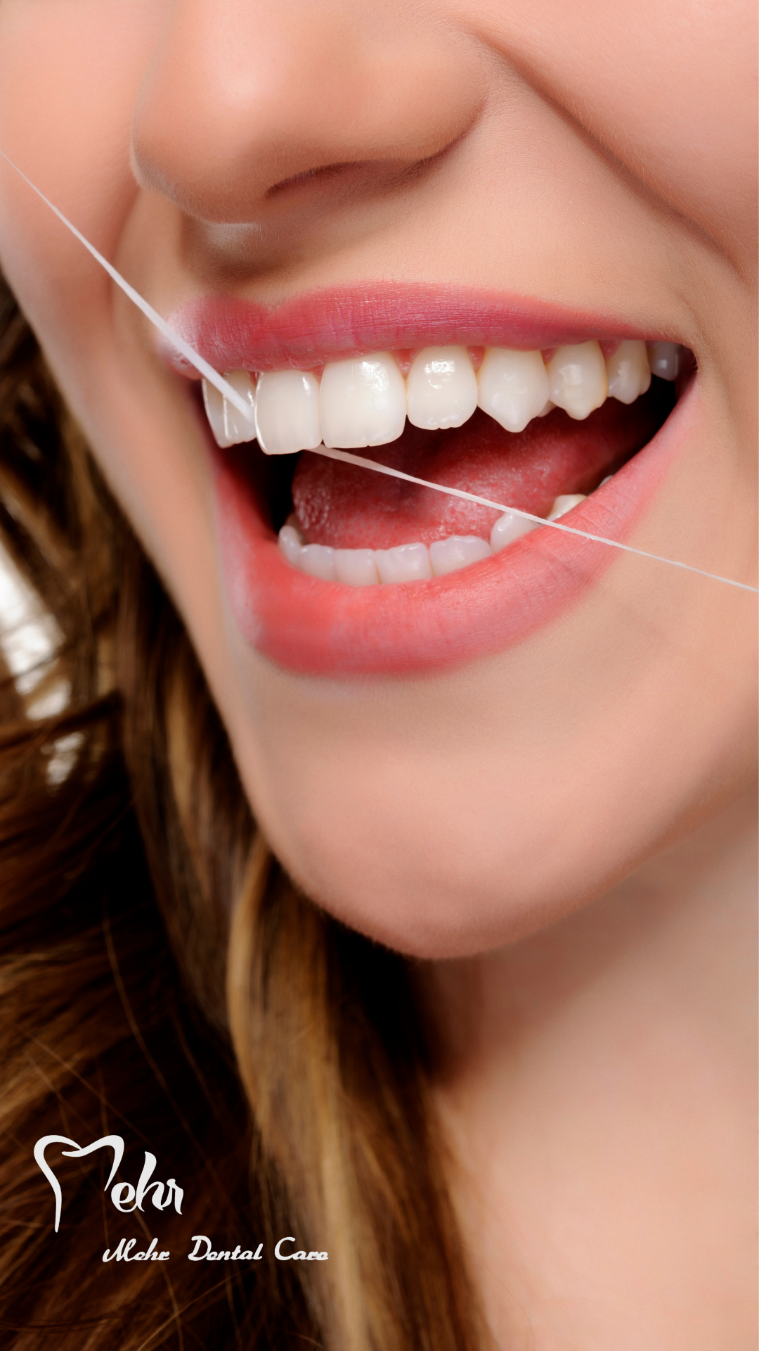 نمونه کار لمینت 2