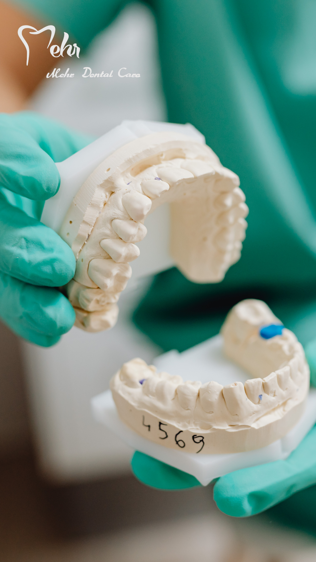 نمونه کار دست دندان 1