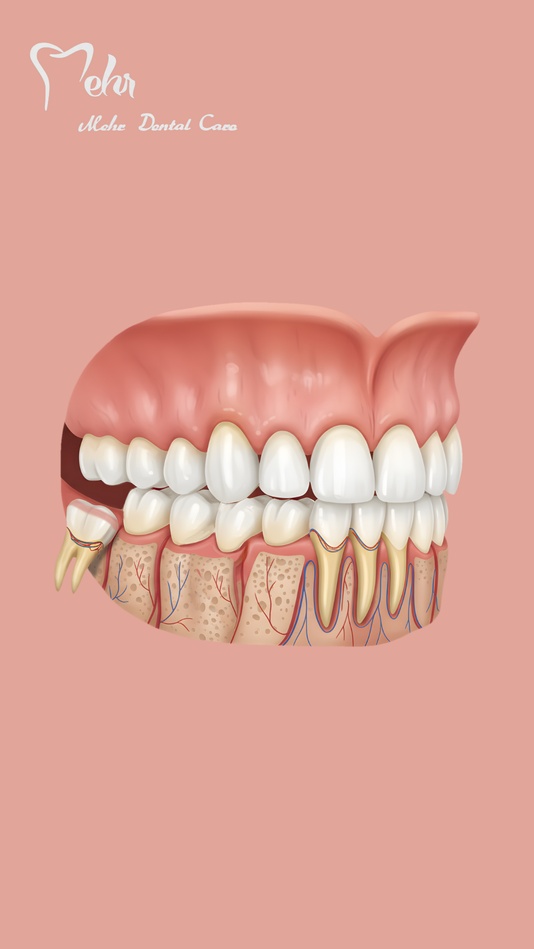 کاور ویدیو توالی جراحی 2